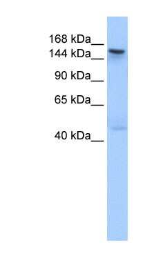 Western Blot: Tex14 Antibody [NBP1-54999]