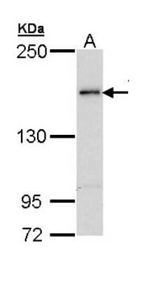 Western Blot: Tex14 Antibody [NBP2-20605]