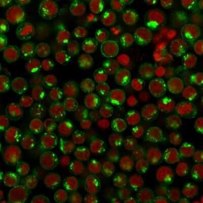 Immunocytochemistry/ Immunofluorescence: TfR (Transferrin R) Antibody (DF1513) - Azide and BSA Free [NBP2-34602]