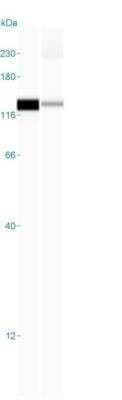 Simple Western: TfR (Transferrin R) Antibody (DF1513) [NBP2-32945]
