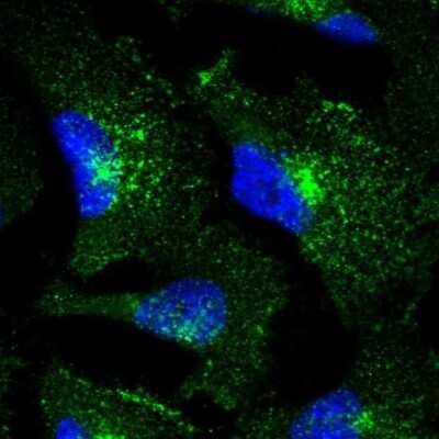 Immunocytochemistry/ Immunofluorescence: TfR (Transferrin R) Antibody [NBP1-85741]