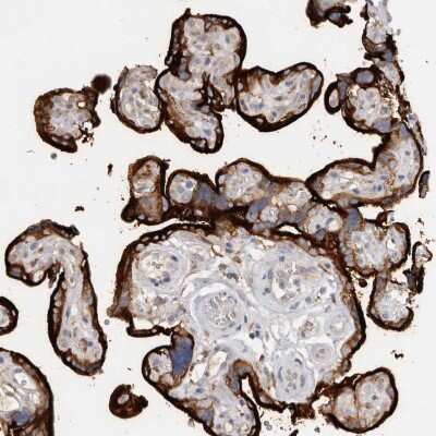 Immunohistochemistry-Paraffin: TfR (Transferrin R) Antibody [NBP1-85741]