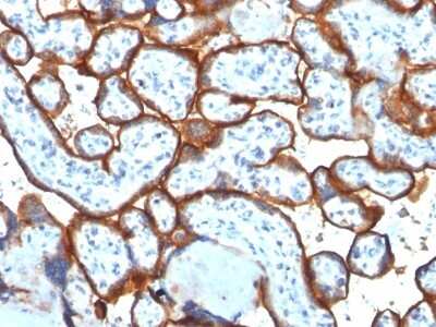 Immunohistochemistry-Paraffin: TfR (Transferrin R) Antibody (TFRC/1817) [NBP2-53274]