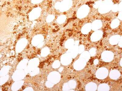 Immunohistochemistry-Paraffin: TfR (Transferrin R) Antibody (TFRC/1817) [NBP2-53274]