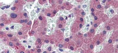 Immunohistochemistry: TfR2 Antibody [NBP2-86864]