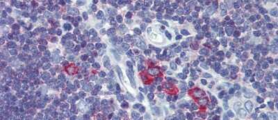Immunohistochemistry: TfR2 Antibody [NBP2-86865]