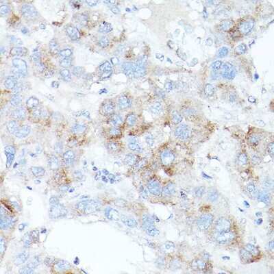 Immunohistochemistry-Paraffin: TfR2 Antibody - Azide and BSA Free [NBP2-93436]
