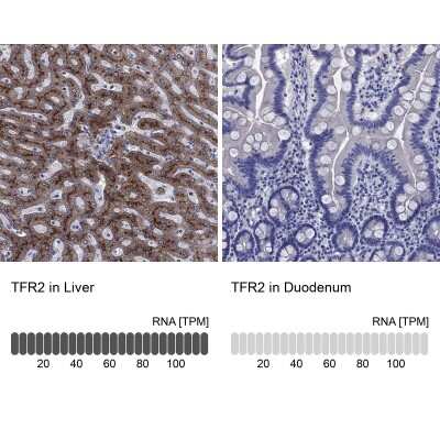 Immunohistochemistry-Paraffin: TfR2 Antibody [NBP3-17003]