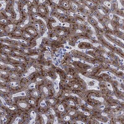 Immunohistochemistry-Paraffin: TfR2 Antibody [NBP3-17003]