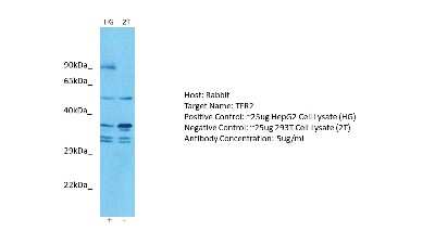 Western Blot: TfR2 Antibody [NBP2-86864]