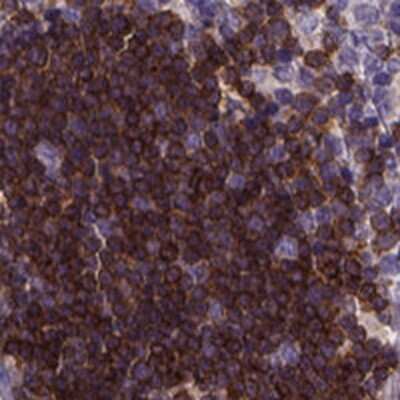 Immunohistochemistry-Paraffin: Themis Antibody [NBP1-90802]