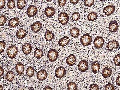 Immunohistochemistry-Paraffin: Thioredoxin-2 Antibody (054) [NBP2-90123]