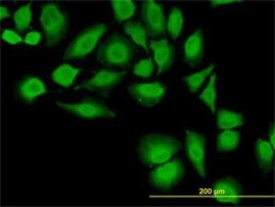 Immunocytochemistry/ Immunofluorescence: Thioredoxin-1 Antibody (2A7) [H00007295-M01]