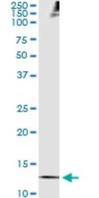 Immunoprecipitation: Thioredoxin-1 Antibody (2A7) [H00007295-M01]