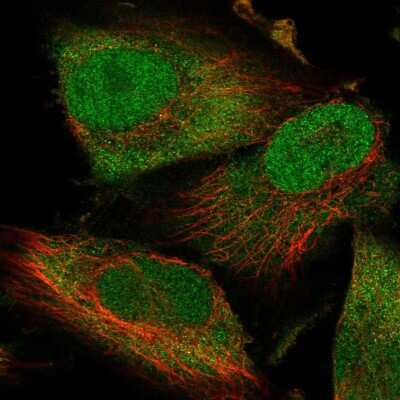 Immunocytochemistry/ Immunofluorescence: Thioredoxin-1 Antibody [NBP2-48873]