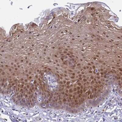 Immunohistochemistry-Paraffin: Thioredoxin-1 Antibody [NBP2-48873]