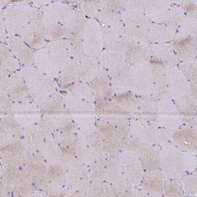 Immunohistochemistry-Paraffin: Thioredoxin-1 Antibody [NBP2-48873]