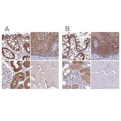 Immunohistochemistry-Paraffin: Thioredoxin-1 Antibody [NBP2-48873]
