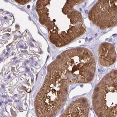 Immunohistochemistry-Paraffin: Thioredoxin-1 Antibody [NBP2-48873]