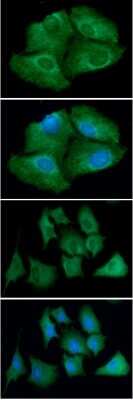 Immunocytochemistry/ Immunofluorescence: Thioredoxin Reductase 1/TRXR1 Antibody (30F1) - BSA Free [NBP2-59489]
