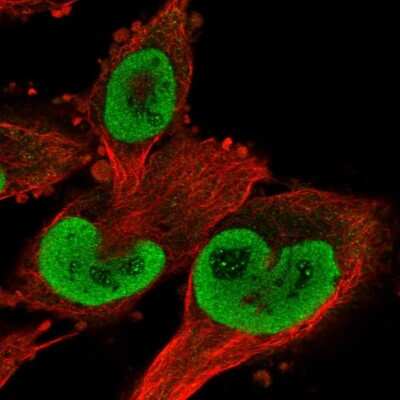 Immunocytochemistry/ Immunofluorescence: Thioredoxin Reductase 1/TRXR1 Antibody [NBP2-55363]