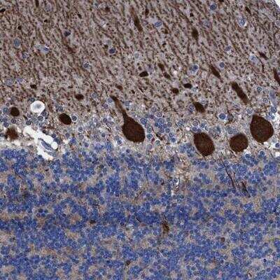 Immunohistochemistry-Paraffin: Thioredoxin-like 5/TRP14/TXNDC17 Antibody [NBP1-81204]