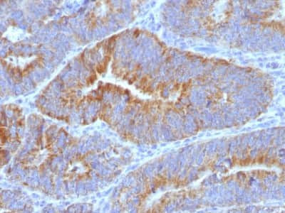 Immunohistochemistry-Paraffin: Thomsen-Friedenreich Antigen Antibody (SPM320) [NBP2-45282]