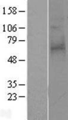 Western Blot: PAR3/Thrombin Receptor-like 2 Overexpression Lysate [NBP2-04264]