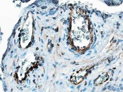 Immunohistochemistry-Paraffin: Thrombomodulin/BDCA-3 Antibody (6C8.2F9) - Azide and BSA Free [NBP2-80979]