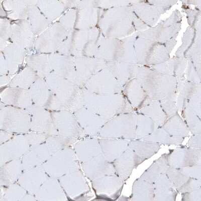 Immunohistochemistry-Paraffin: Thrombomodulin/BDCA-3 Antibody [NBP1-88133]