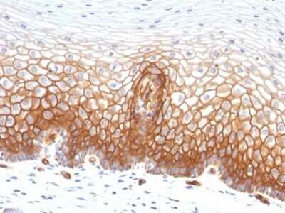 Immunohistochemistry-Paraffin: Thrombomodulin/BDCA-3 Antibody (THBD/1591) - Azide and BSA Free [NBP2-54490]