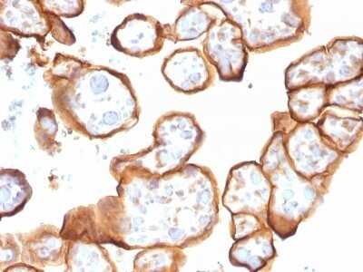 Immunohistochemistry-Paraffin: Thrombomodulin/BDCA-3 Antibody (THBD/1591) - Azide and BSA Free [NBP2-54490]