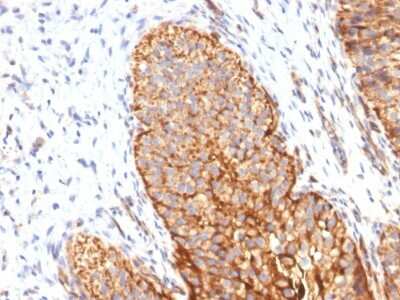 Immunohistochemistry-Paraffin: Thrombomodulin/BDCA-3 Antibody (THBD/1591) [NBP2-53206]