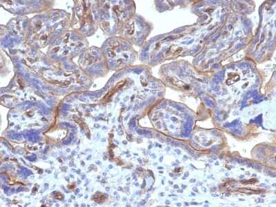 Immunohistochemistry-Paraffin: Thrombomodulin/BDCA-3 Antibody (THBD/1782) - Azide and BSA Free [NBP2-54496]