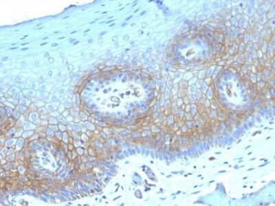 Immunohistochemistry-Paraffin: Thrombomodulin/BDCA-3 Antibody (THBD/1782) [NBP2-53273]