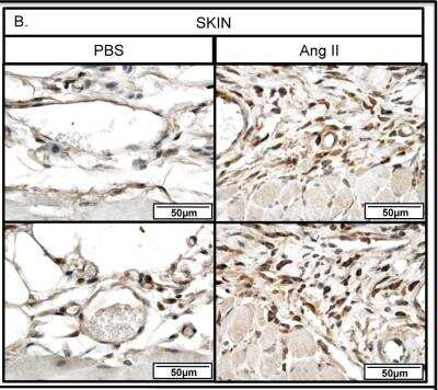 Immunohistochemistry-Paraffin: Thrombospondin-1 Antibody (A6.1) [NB100-2059]