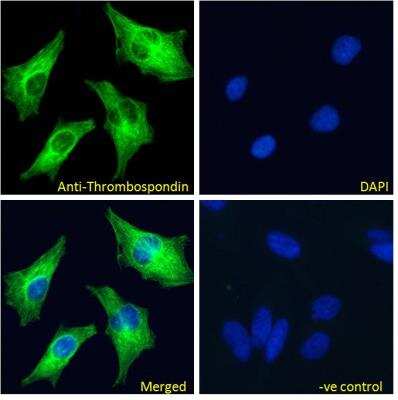 Immunocytochemistry/ Immunofluorescence: Thrombospondin-1 Antibody [NBP2-42522]