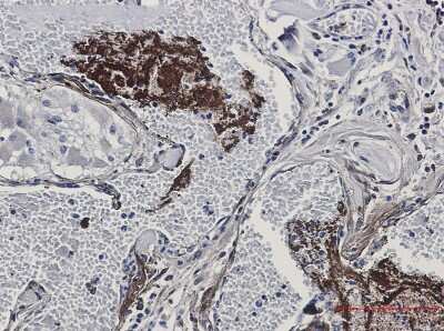 Immunohistochemistry-Paraffin: Thrombospondin-1 Antibody (S06-5F3) [NBP3-15101]