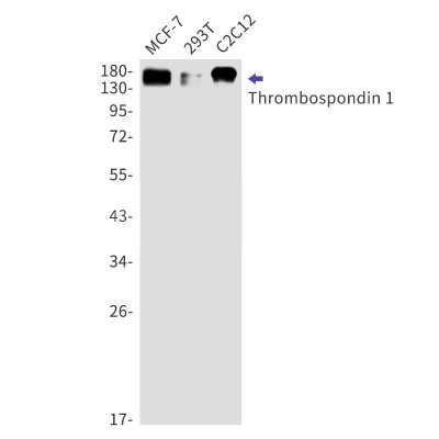 Western Blot: Thrombospondin-1 Antibody (S06-5F3) [NBP3-15101]