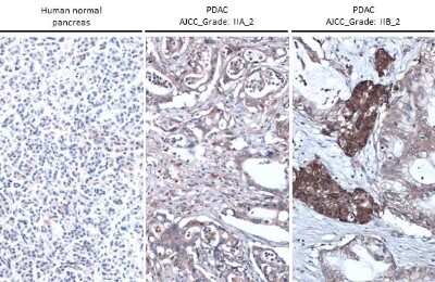 Immunohistochemistry-Paraffin: Thrombospondin-2 Antibody (GT147) [NBP3-13654]