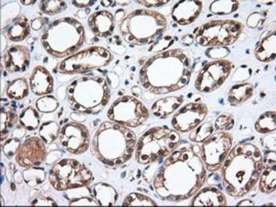 Immunohistochemistry-Paraffin: Thromboxane synthase Antibody (OTI2C1) [NBP2-02710]