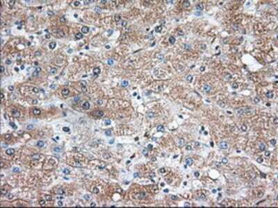 Immunohistochemistry-Paraffin: Thromboxane synthase Antibody (OTI2C1) [NBP2-02710]