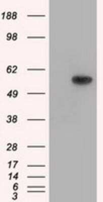 Western Blot: Thromboxane synthase Antibody (OTI2C1) [NBP2-02710]