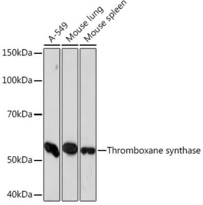 Western Blot: Thromboxane synthase Antibody (6B7Z7) [NBP3-16581]
