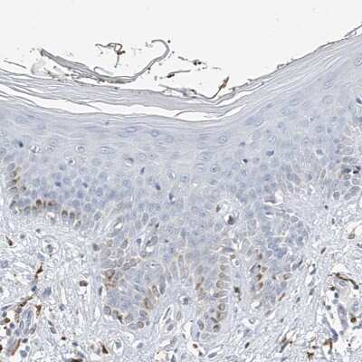 Immunohistochemistry-Paraffin: Thromboxane synthase Antibody [NBP2-33946]