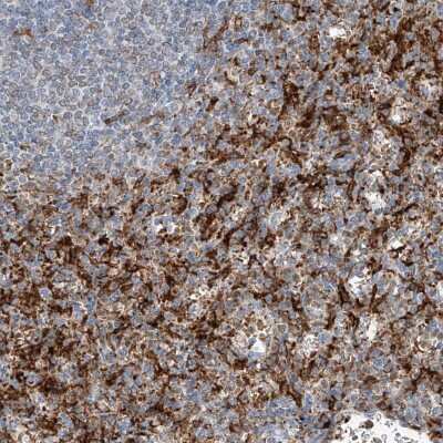 Immunohistochemistry-Paraffin: Thromboxane synthase Antibody [NBP2-33946]