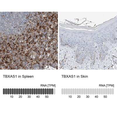 Immunohistochemistry-Paraffin: Thromboxane synthase Antibody [NBP2-33946]