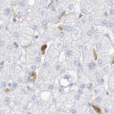 Immunohistochemistry-Paraffin: Thromboxane synthase Antibody [NBP2-33947]
