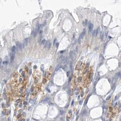 Immunohistochemistry-Paraffin: Thromboxane synthase Antibody [NBP2-33947]