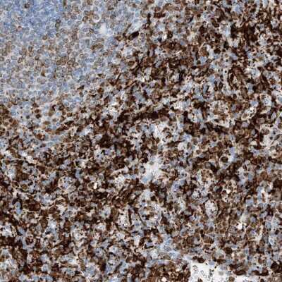 Immunohistochemistry-Paraffin: Thromboxane synthase Antibody [NBP2-33948]